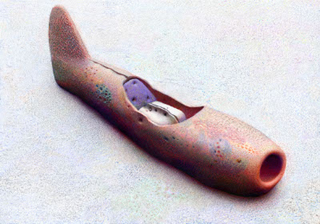 mig